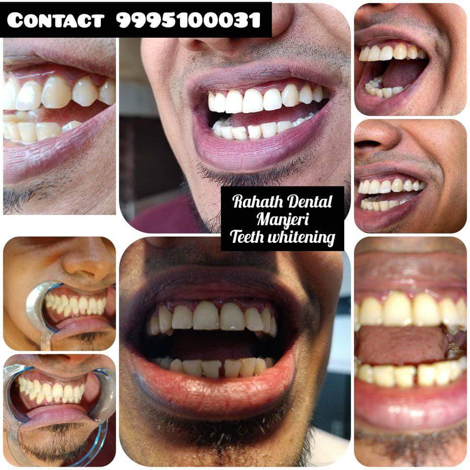 RAHATH MULTI SPECIALITY DENTAL CLINIC