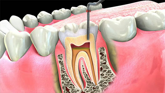 RAHATH MULTI SPECIALITY DENTAL CLINIC