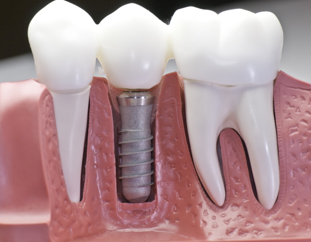 RAHATH MULTI SPECIALITY DENTAL CLINIC
